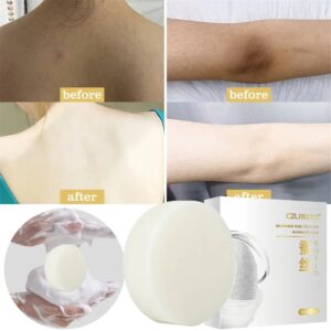 Body Whitening Soap Underarm Knee Bleaching Soap Chicken Skin Removal Dark Spot Removal Dead Skin Moisturize