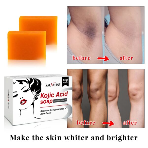 Kojic Acid Soap Original Whitening Hand Soap Brightening Products Inhibit Melanin Formation Remove Black Spots Improve